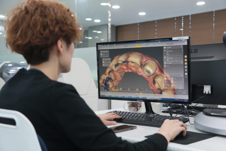 Dental technician designing customized veneers and restorations with MINISH digital design software.