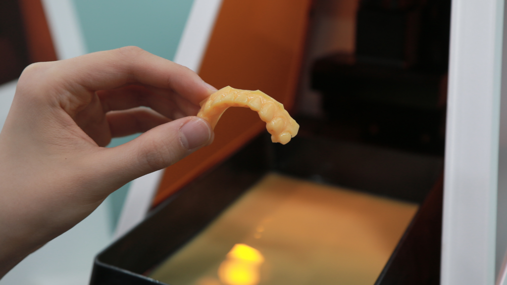 An almost finished MINISH veneer undergoing final refinement for precision fit and natural esthetics.