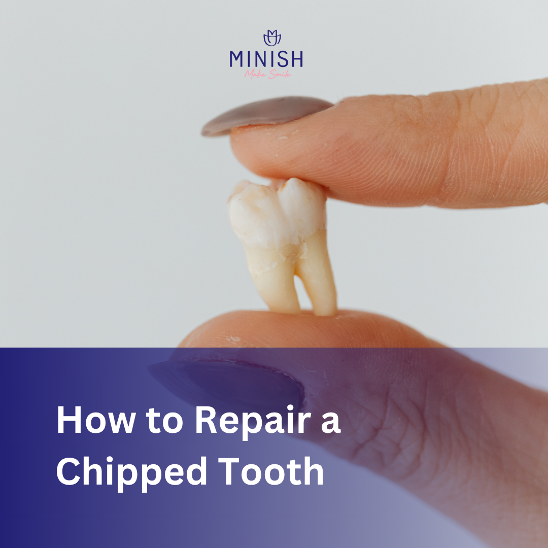 Patient receiving MINISH Veneer treatment to repair a chipped tooth and restore a natural smile.