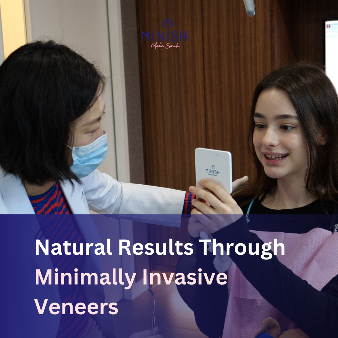 Natural Results Through Minimally Invasive Veneers
