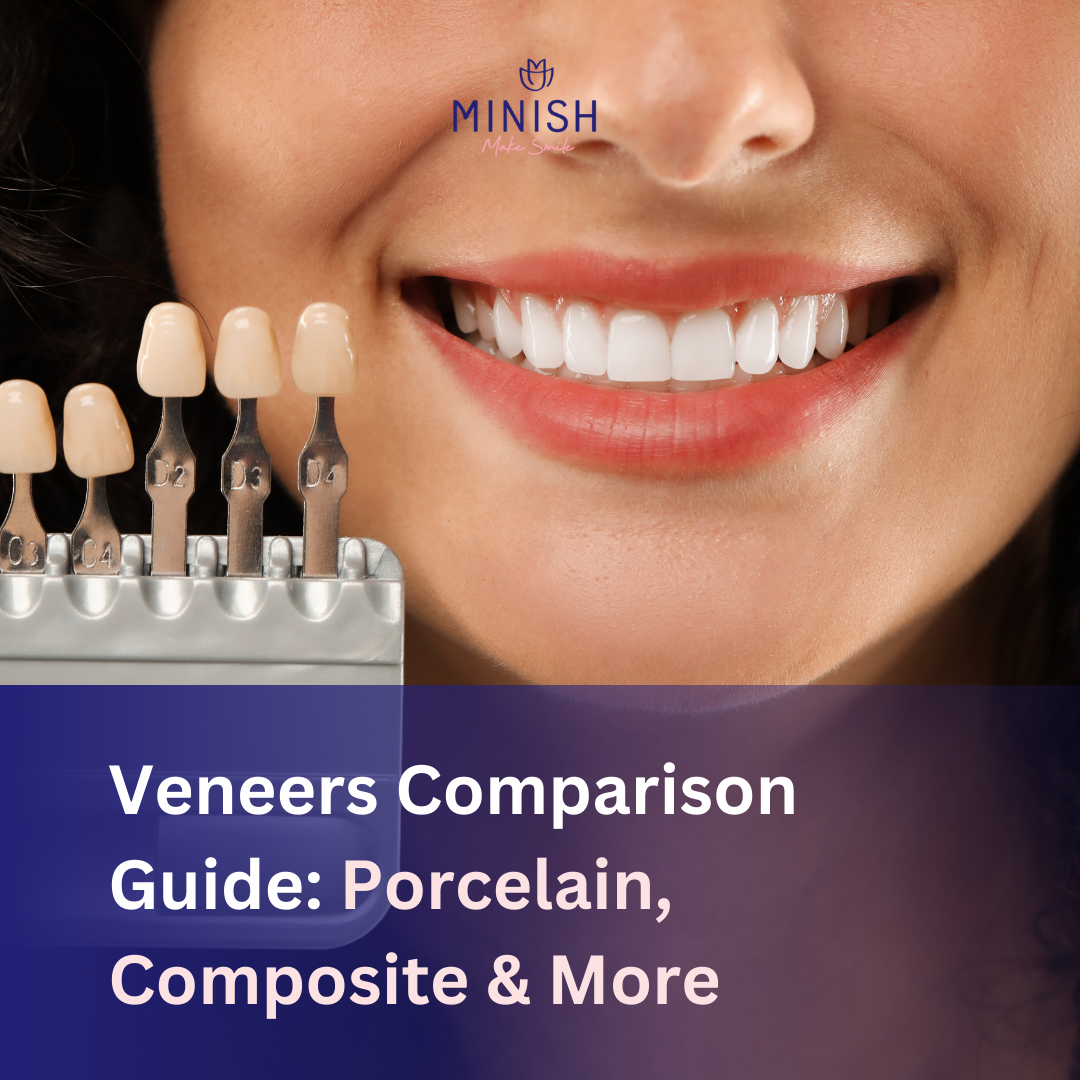 Veneers Comparison Guide: Porcelain, Composite & More