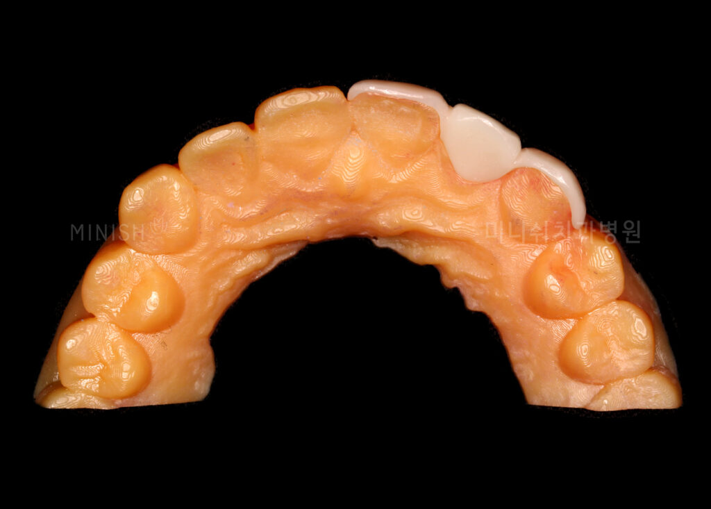 A 3D illustration of a white molar tooth balanced on a marble scale against stacks of gold coins, symbolizing long-term value.